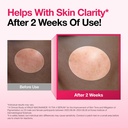 Anua - Niacinamide 10 TXA 4 Serum
