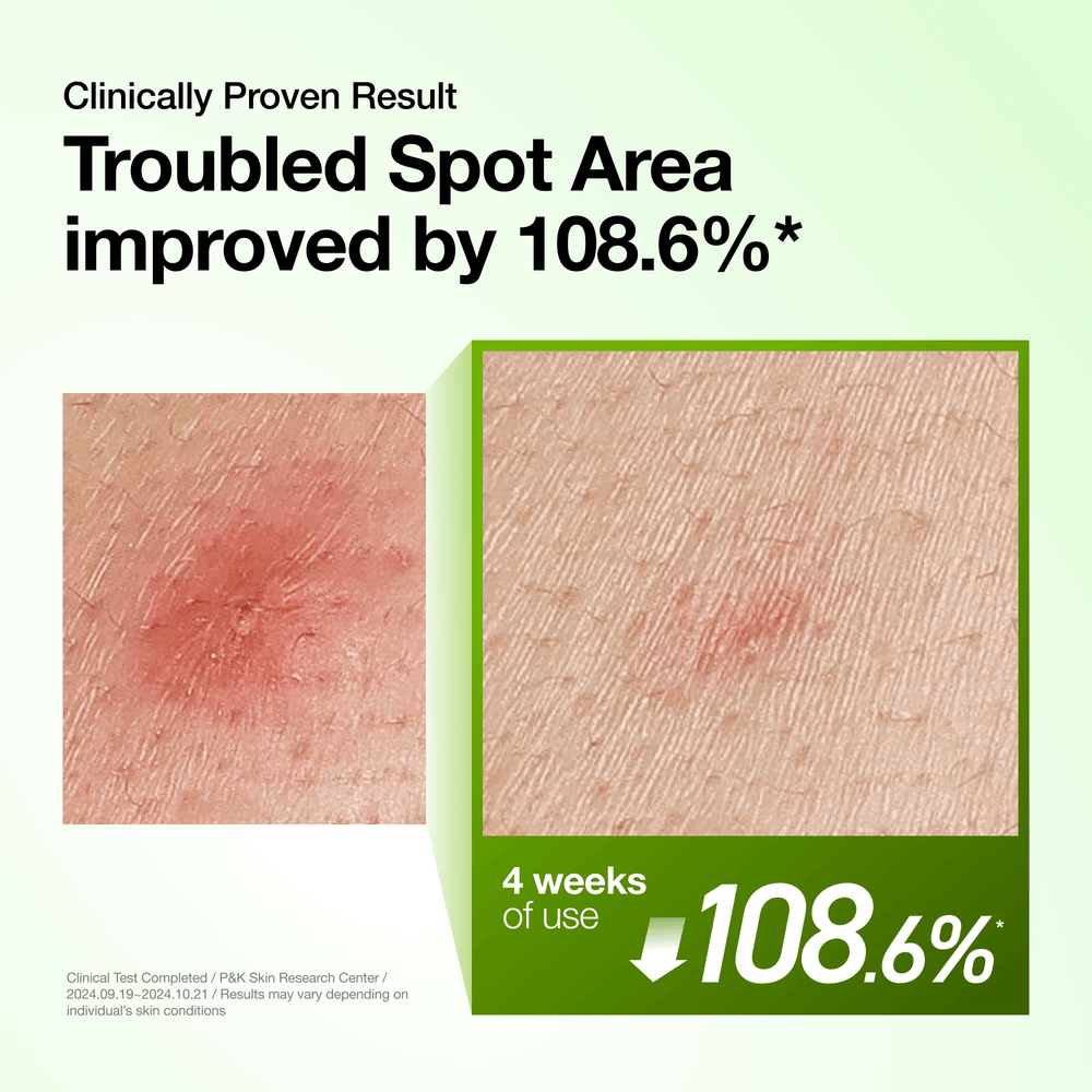 Anua -  Azelaic Acid 10 Hyaluron Redness Soothing Serum