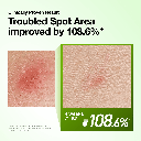 Anua -  Azelaic Acid 10 Hyaluron Redness Soothing Serum